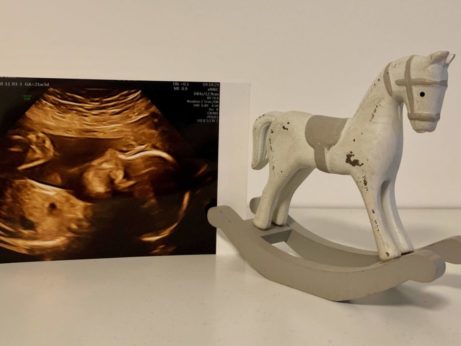 ultrazvuk dítěte a dětský koník