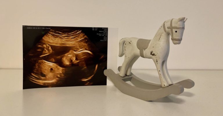 ultrazvuk dítěte a dětský koník